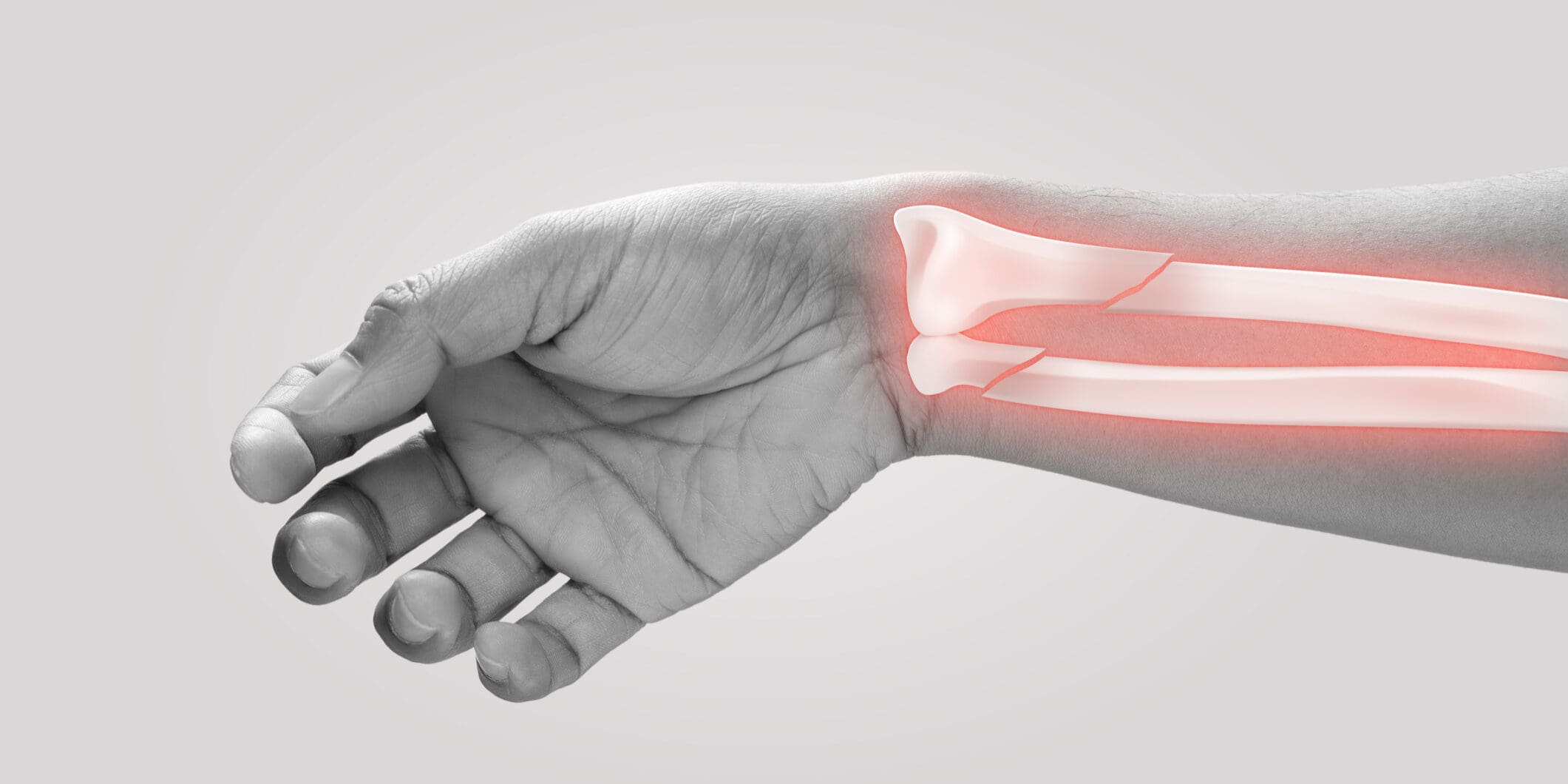 Men at higher risk of ulna fracture Pain concept